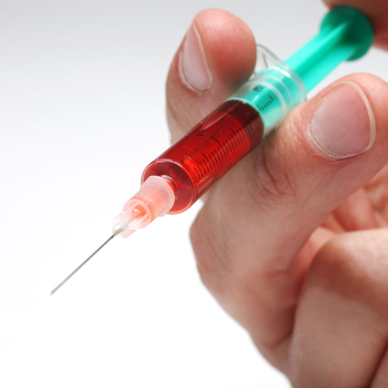 Naturheilpraxis Mai - Eigenbluttherapie